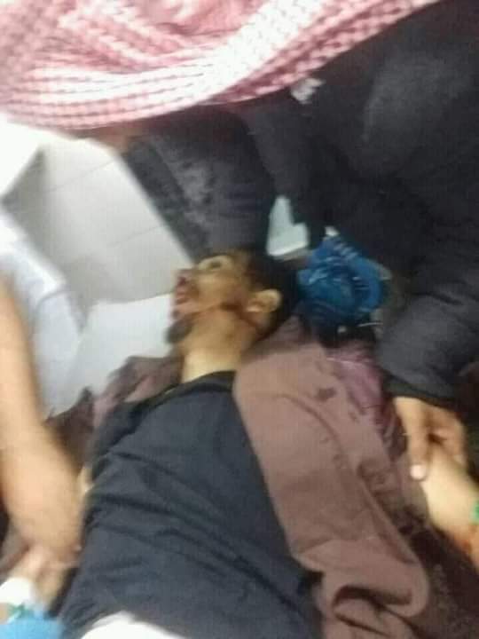 محافظة الضالع تشهد عملية اغتيال 