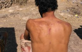 نقطه لمليشيات الحوثي بمراوسه ماوية تعتدي على مواطن  بضرب باعقاب البنادق