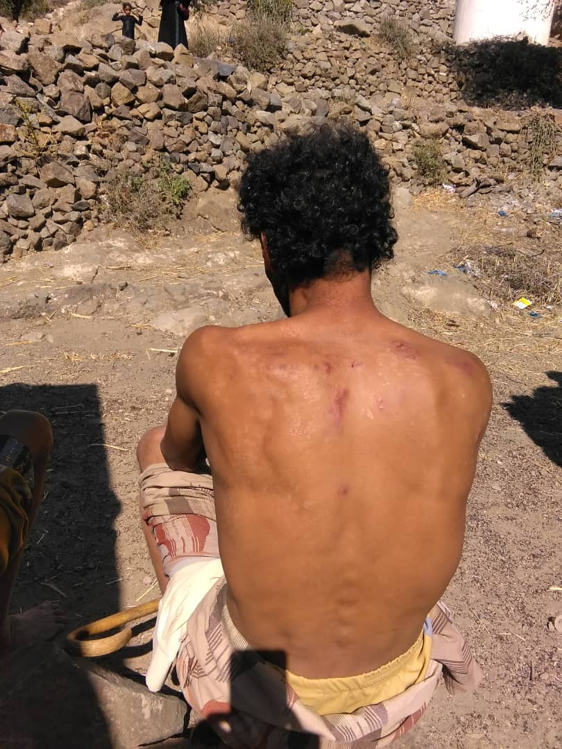 نقطه لمليشيات الحوثي بمراوسه ماوية تعتدي على مواطن  بضرب باعقاب البنادق