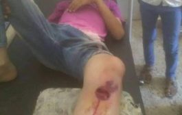 إصابة مدنيين بينهم أطفال في حادثين منفصلين شمال غرب الضالع
