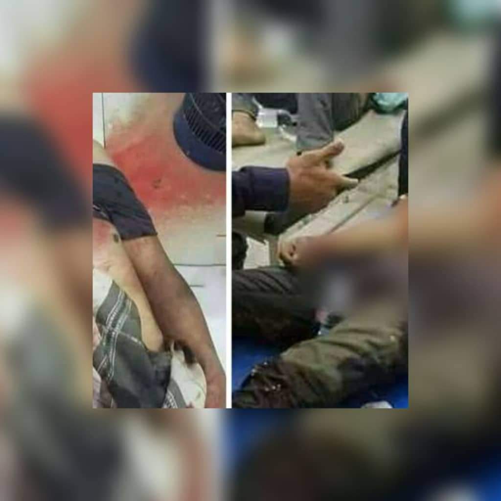 مقتل وإصابة مدنيين بقذائف الهاون في تعز 