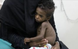 الأمم المتحدة تخصص 30 مليون دولار للمساعدات في اليمن