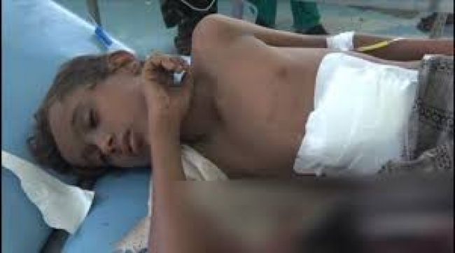 مقذوفات والغام الحوثي تحصد ارواح الاطفال