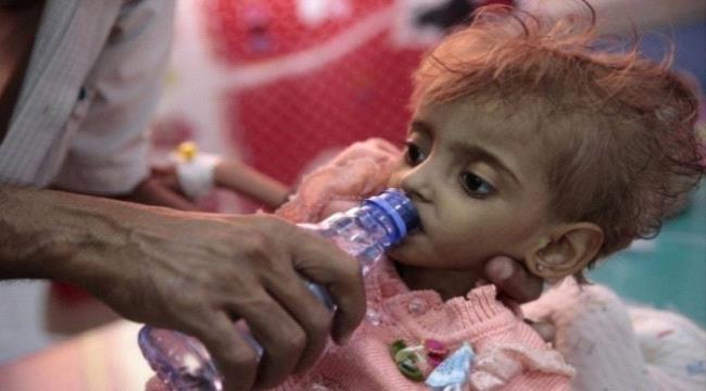 جهات أممية اليمن ضمن 4 دول تقترب من حافة المجاعة