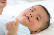 تحذير من خطورة البقع الجلدية الحمراء لدى الأطفال