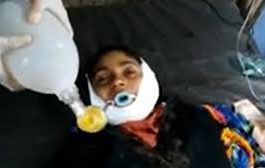 مليشيات الحوثي تصيب طفلة بالرصاص في رقبتها 