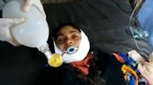 مليشيات الحوثي تصيب طفلة بالرصاص في رقبتها 