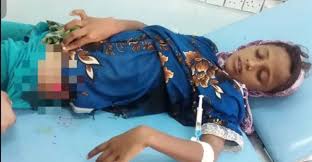مقتل 22 مدني بينهم نساء وأطفال في الحديدة 