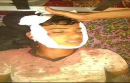 قناص حوثي يقتل طفل بأحد مديريات بمحافظة لحج
