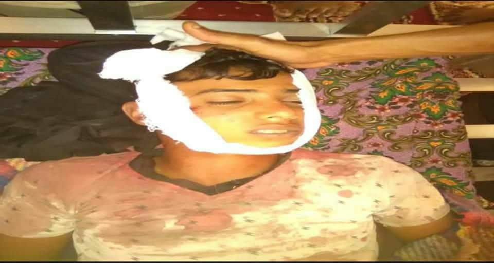 قناص حوثي يقتل طفل بأحد مديريات بمحافظة لحج