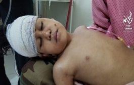 حصيلة مُخيفة لعدد القتلى من النساء والأطفال منذ بداية الحرب في اليمن