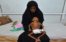 الأمم المتحدة: نصف سكان اليمن سيواجهون الجوع العام المقبل
