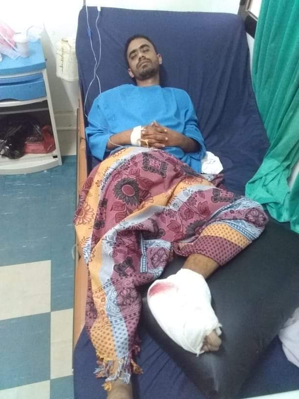 أحد ضحايا مطار عدن تبتر قدمه بسبب إهمال طبي بعدن