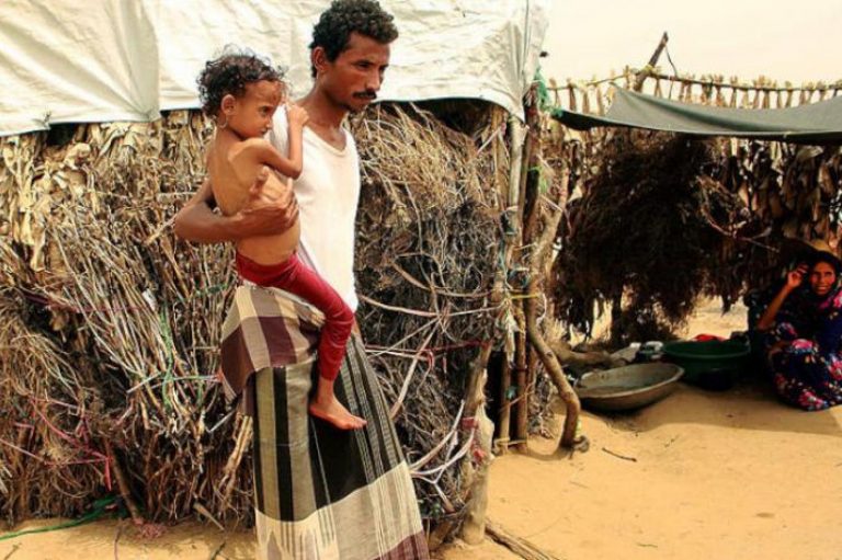نزوح اليمنيين صورة محزنة تجسد مأساة الحرب
