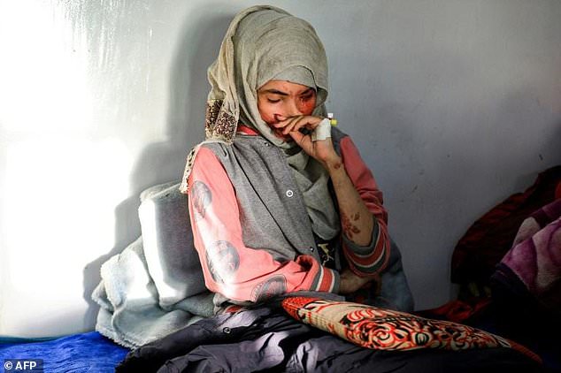 معدلات العنف ضد النساء في مناطق سيطرة الحوثيين يرتفع بنسب غير مسبوقة