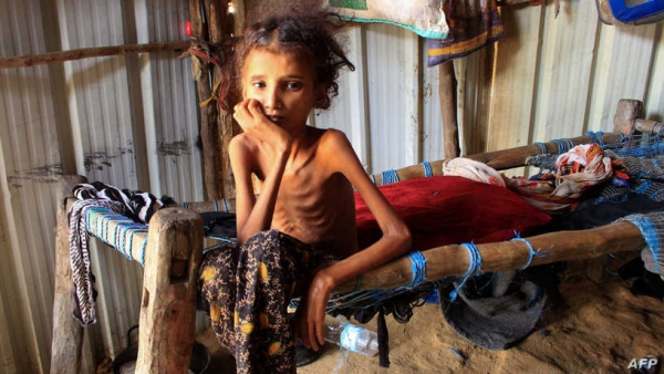 ديفيد بيسلي : طفل يموت كل 70 ثانية في اليمن