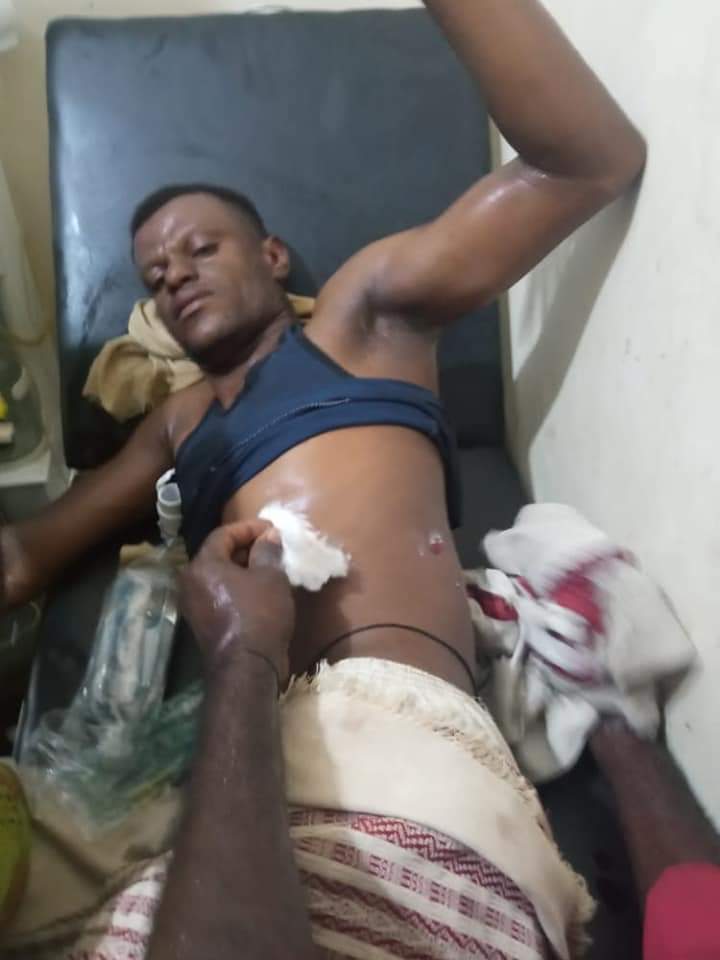 انتقالي حضرموت يعبر عن رفضه استخدام القوة لتفريق المتظاهرين