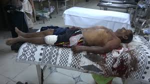 انتهاكات الحوثي تتواصل ..مقتل مواطن واستهداف للمناطق السكنية بالحديدة