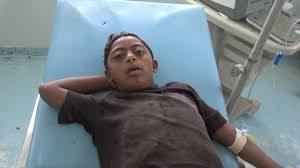 قناص حوثي يصيب طفل في منطقة الدنين