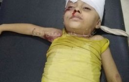 طفل يصارع الموت على قارعة طريق في محافظة لحج
