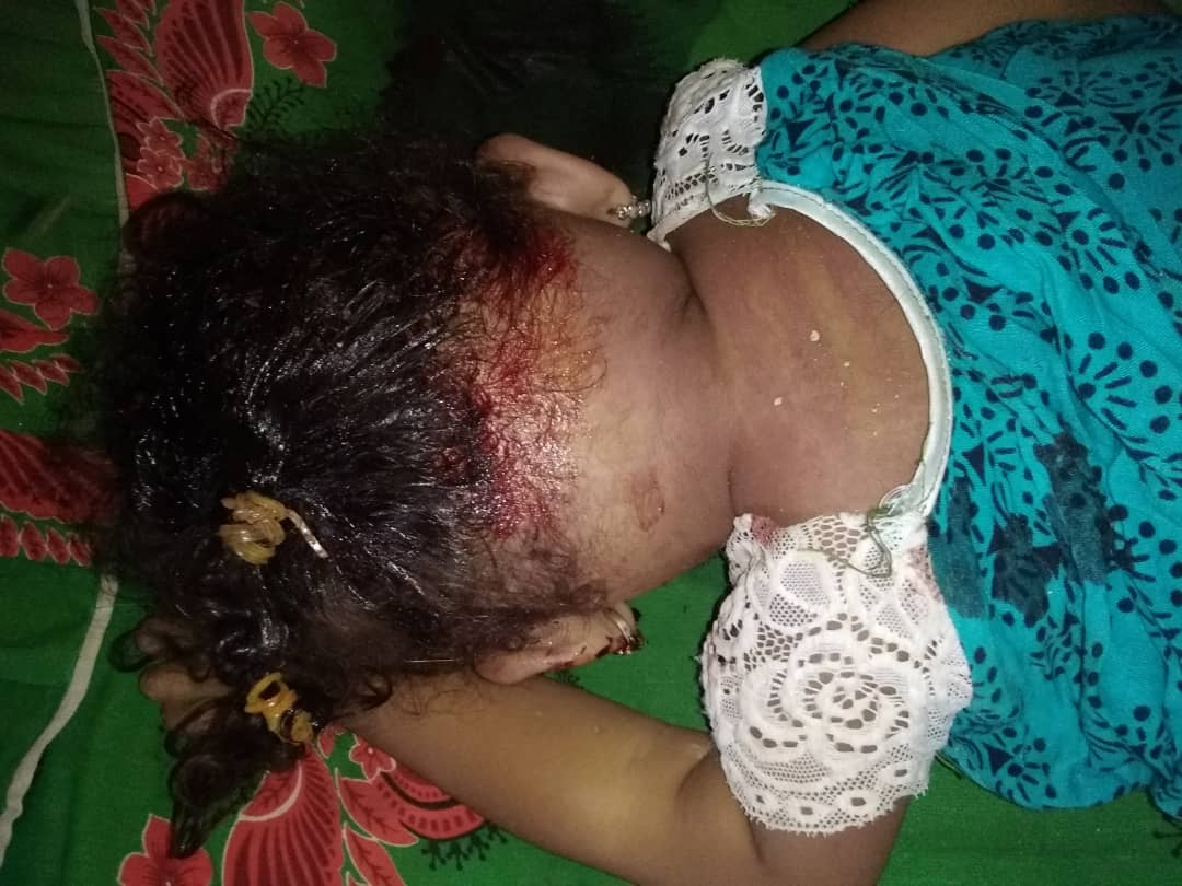 لحج : مقتل طفلة تبلغ من العمر عامان على يد والدها 