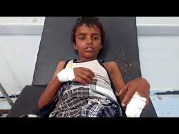 إصابة طفل بقرية العكش ..والقوات المشتركة تحبط هجوم بري وبحري للمليشيات الحوثية