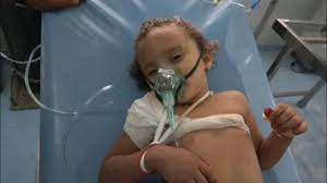 طلق ناري حوثي يهشم عظام طفلة في حيس