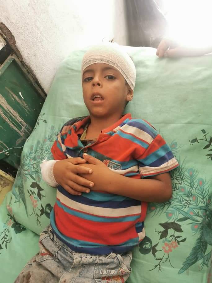 المليشيات الحوثية تقصف عشوائياً قرى ثره وإصابة طفل