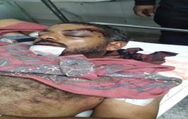 إصابة قائد عسكري جنوبي بانفجار بمنطقة بالضالع