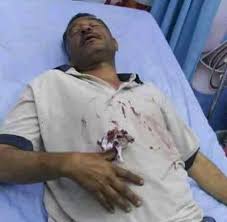 عصابة مُسلحة تعتدي بالضرب وتطعن صحفيًا بصنعاء