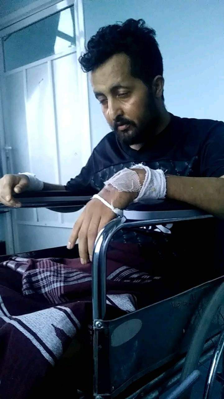 رئيس عمليات جبهة الصلو يقضي متاثراً بجراحه جراء رفض محور تعز انقاذه