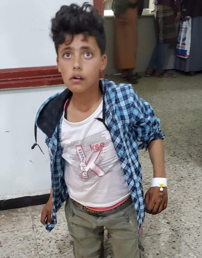 طفل يتهم والده وآخرين بتعذيبه في محافظة إب