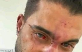 ممثل يمني يتعرض للاعتداء من قبل الشرطة التركية