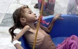 برنامج الغذاء العالمي : تدابير قاسية يتخذها اليمنيون لسد بطونهم الخاوية