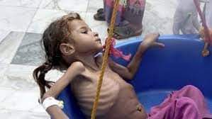 برنامج الغذاء العالمي : تدابير قاسية يتخذها اليمنيون لسد بطونهم الخاوية
