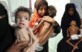 الصحة العالمية : اليمن وصلت الى أعلى معدلات الهزال والتقزم في العالم