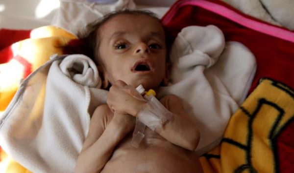الأمم المتحدة تحذر من ارتفاع مستويات انعدام الأمن الغذائي في اليمن