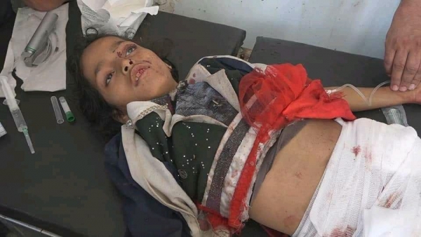 من أسرة واحدة .. مقتل أربعة أطفال بقصف حوثي في تعز