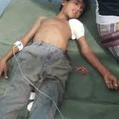 مليشيا الحوثي تصيب طفلا في حيس