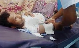 إصابة مواطن بنيران مليشيا الحوثي بحي المغل