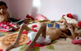 الصحة العالمية: 75 بالمئة من أطفال اليمن يعانون من سوء التغذية المزمن