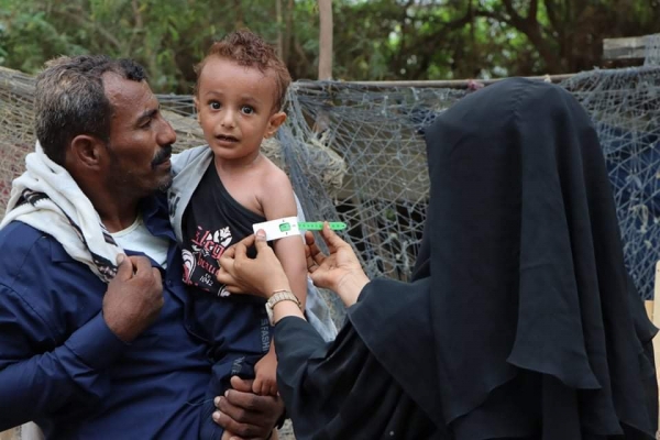 لتفادي مجاعة وشيكة .. اليونيسف تعلن توسيع برنامج استجابتها التغذوي في اليمن
