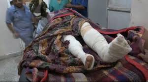 إصابة امرأة وسقوط ٦ من عناصر المليشيا الحوثي بالتحيتا