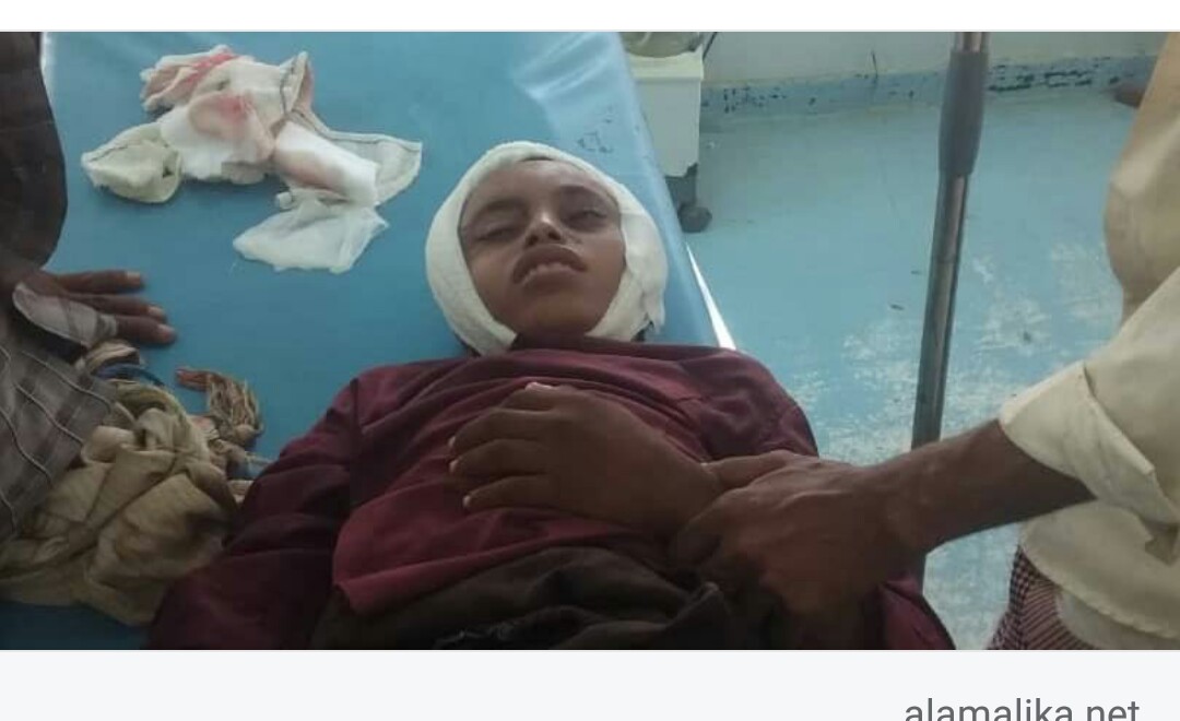 قناص حوثي يصيب طفل في منطقة لودية