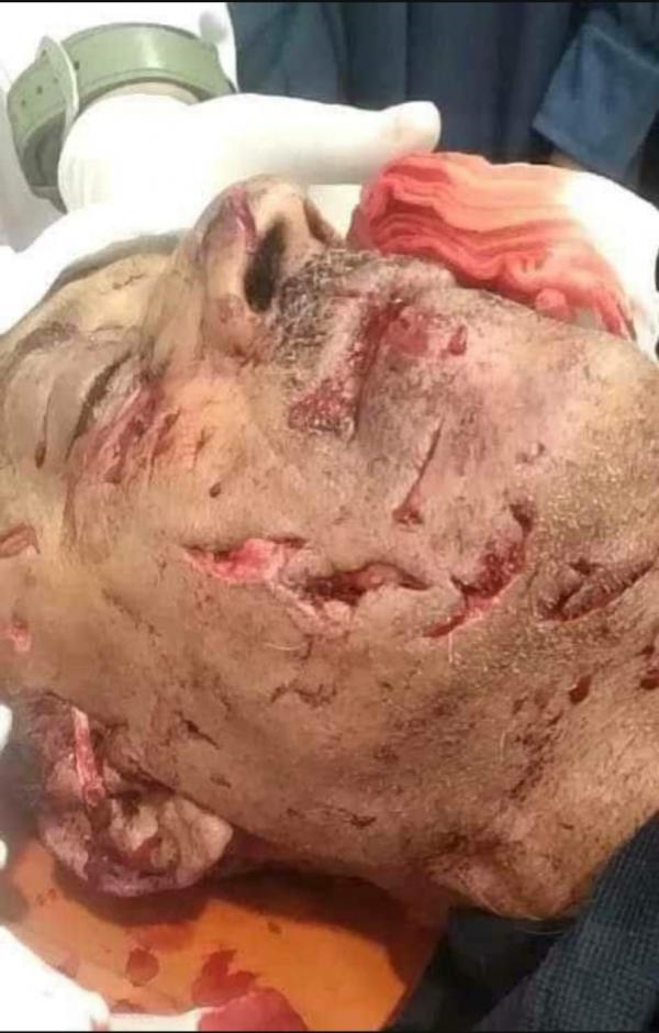نمر يهاجم عامل في حديقة الحيوان بتعز