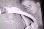 مقتل طفل بانفجار جنوب الحديدة 