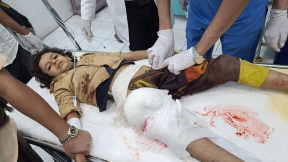 الأمم المتحدة تعلن مقتل 234 مدنيًا خلال يناير الماضي في اليمن