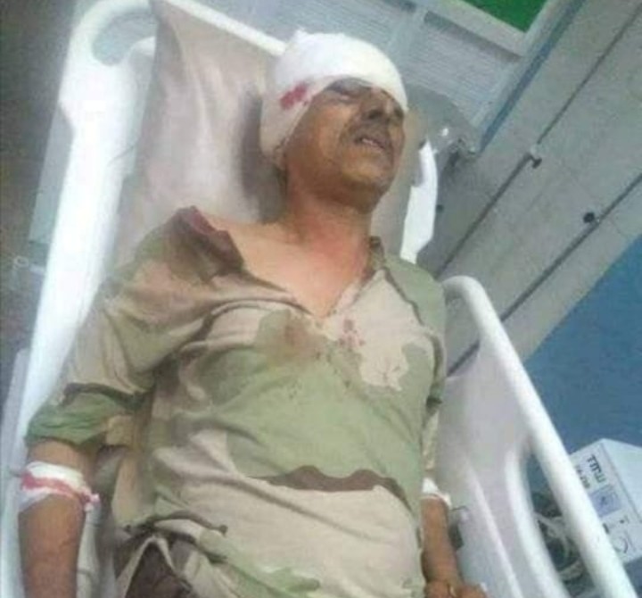 إصابة قيادي بارز في جبهة الجب بالضالع