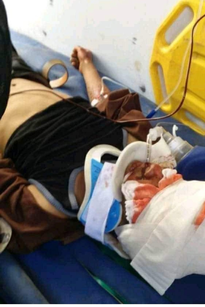 يعقوب الازرقي ضحية اطلاق نار بين مسلحين في محافظة الضالع