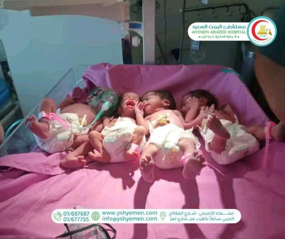 ولادة أربعة أطفال توأم في صنعاء 